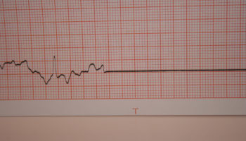 Bitcoin Volatilitesi